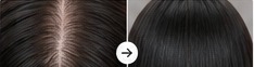 Sample hair restoration result