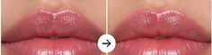 Sample lips PMU result