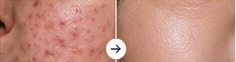 Sample skin treatment result